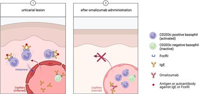 Frontiers The Potential Role Of Basophils In Urticaria